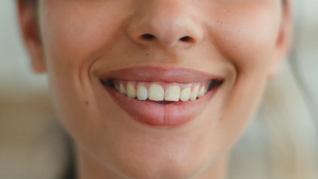 Close-up of a natural, radiant smile