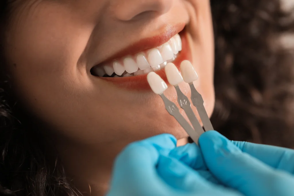 Dentist holding tooth shade samples against a patient's smile