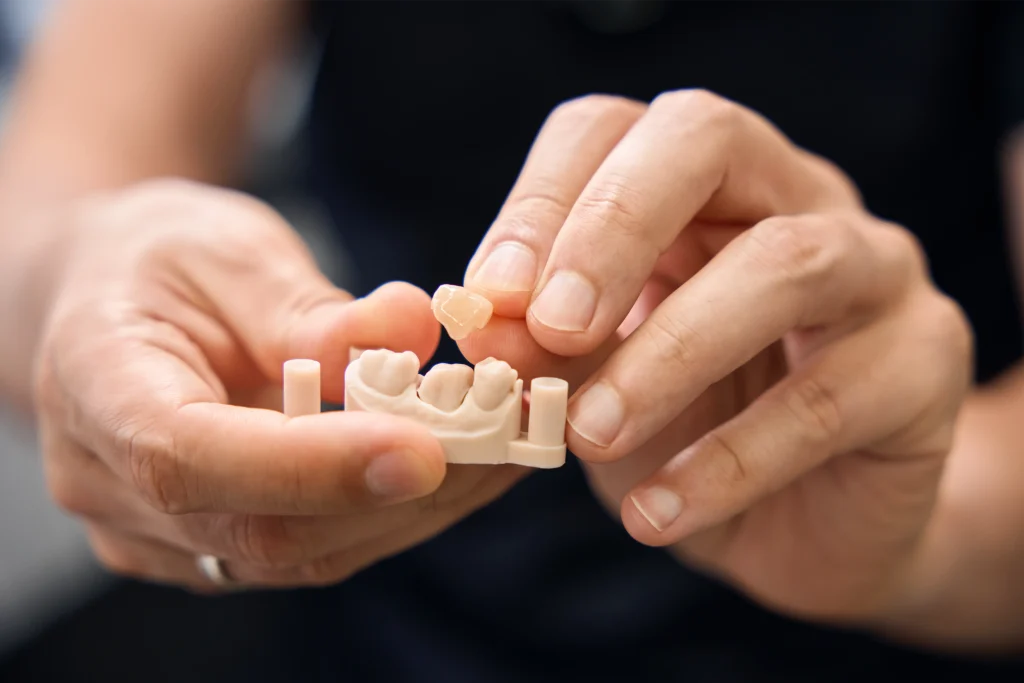 Hands holding a model of an implant-supported dental bridge