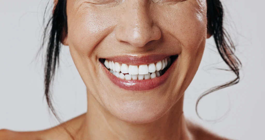 Close-up of a bright, healthy smile